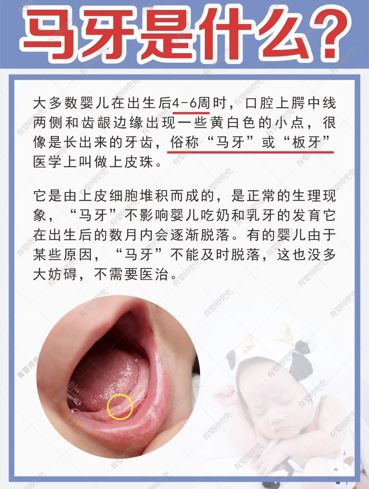 西安一位宝妈发现两个月大的宝宝牙龈上有黄白色小点点，奶奶一看就笃定是长牙不舒服，
