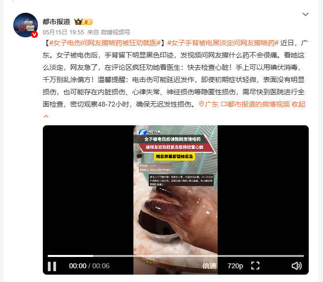 女子电伤问网友擦啥药被狂劝就医 被电伤了不问去不去医院，先问擦什么药不疼，这操作