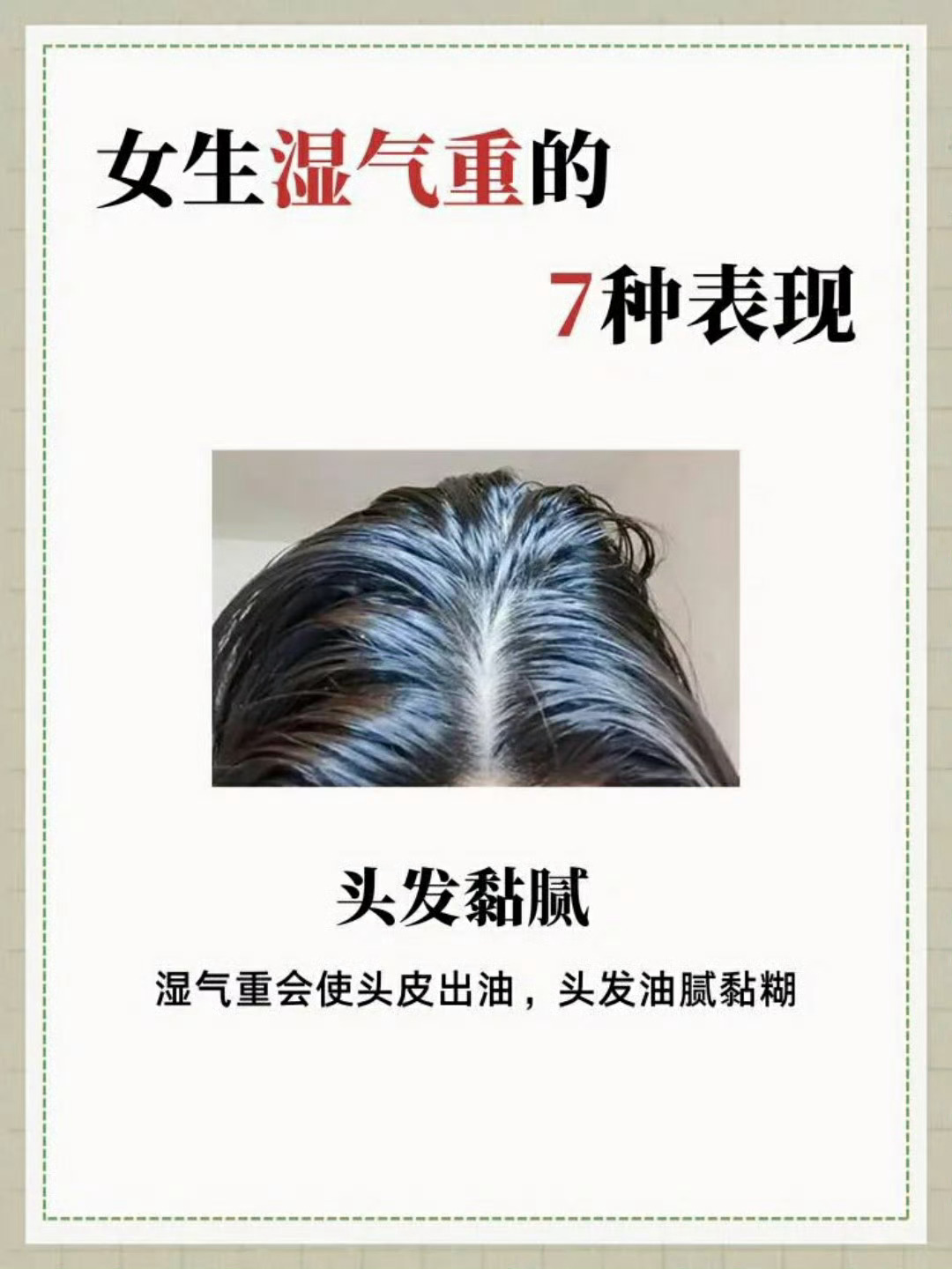 湿气重的七种表现形式 ​​​