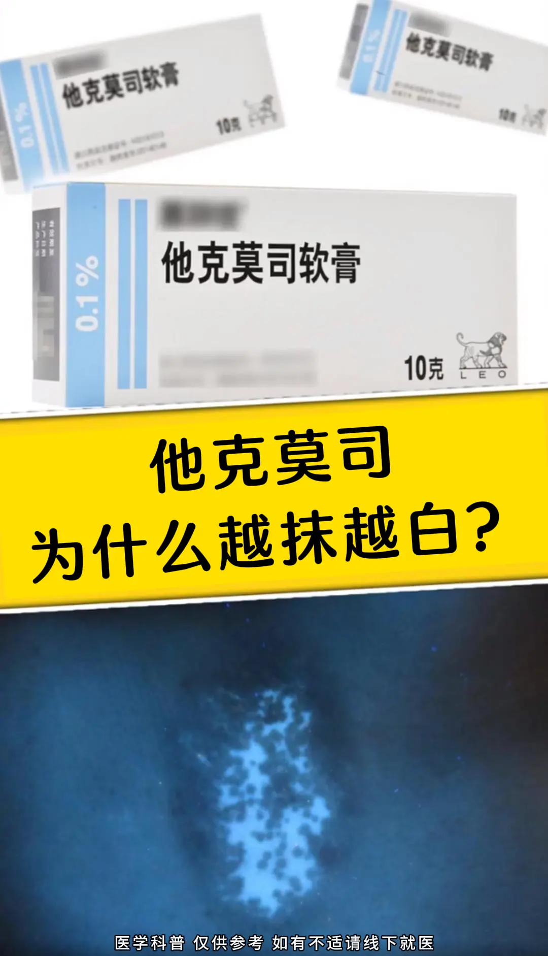 他克莫司是治疗白癜风的常用药，一般不会导致越抹越白，出现这种情况可能有...