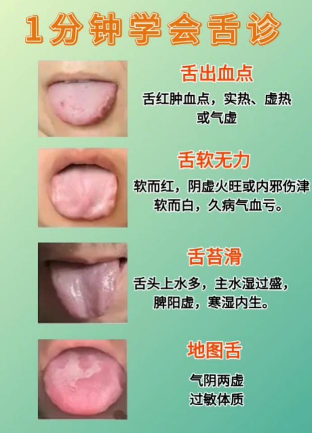自查体质！多种典型舌象，看看你属于哪一种