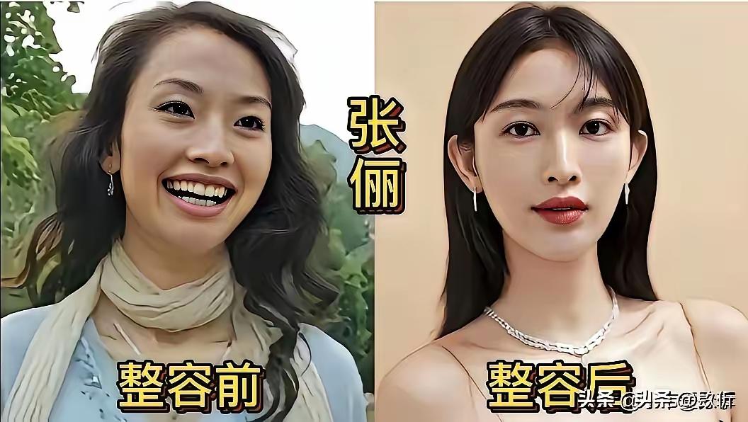 熊黛林整容整的真的是太成功了，整容前可以演聊斋，整容后可以演富太。以前也不能说是