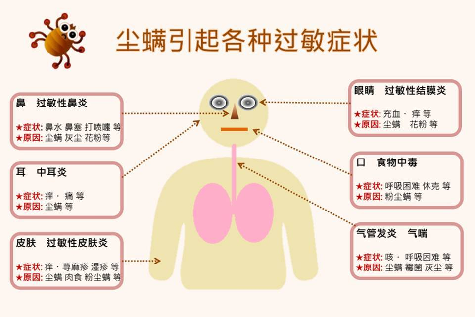 尘螨过敏怎么办？#儿童健康守护者计划# 在除螨工作开始前，要让宝宝离开。以免在清