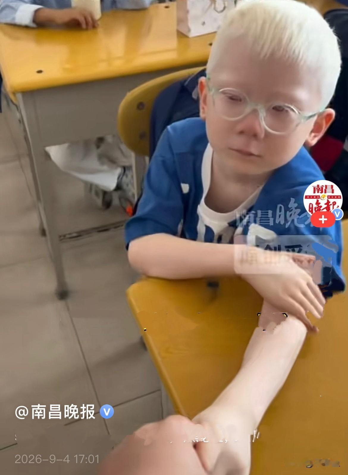 近日，黑龙江新学期开学，一位可爱的白化病小朋友踏入小学校园，入学第一天，妈妈送孩