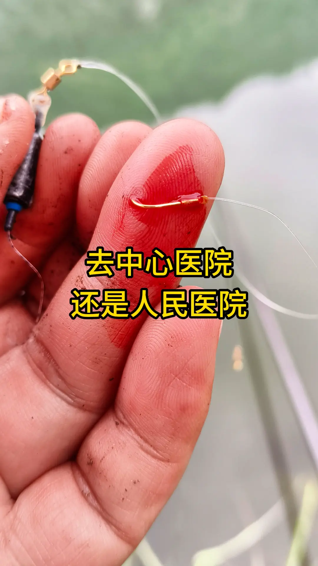 今天被勾到了，带倒刺的😂