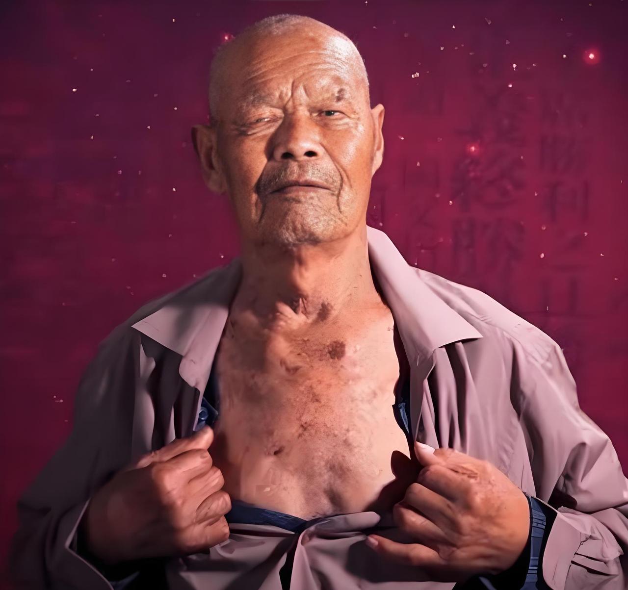 [太阳]1956年，35岁的农民咳嗽10年，但却一直拒绝就医，一天，他突然用力一