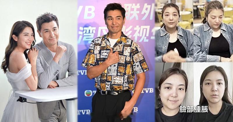 明报：称老婆单文柔感染过滤性病毒 陈展鹏体检报告佳：可以再生小朋友电视广播有限公