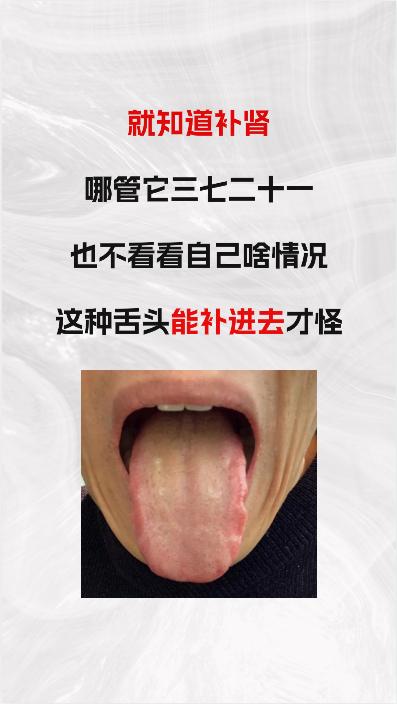 有的患者，也不管三七二十一，自己啥情况，就知道补肾，看这个舌头，你能补进去，那真