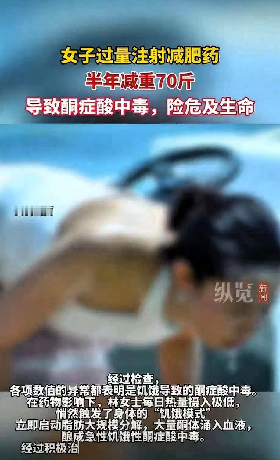 太惊心了！浙江林女士为了快速瘦下来，自行注射网红减肥药，半年内从160斤猛降到9