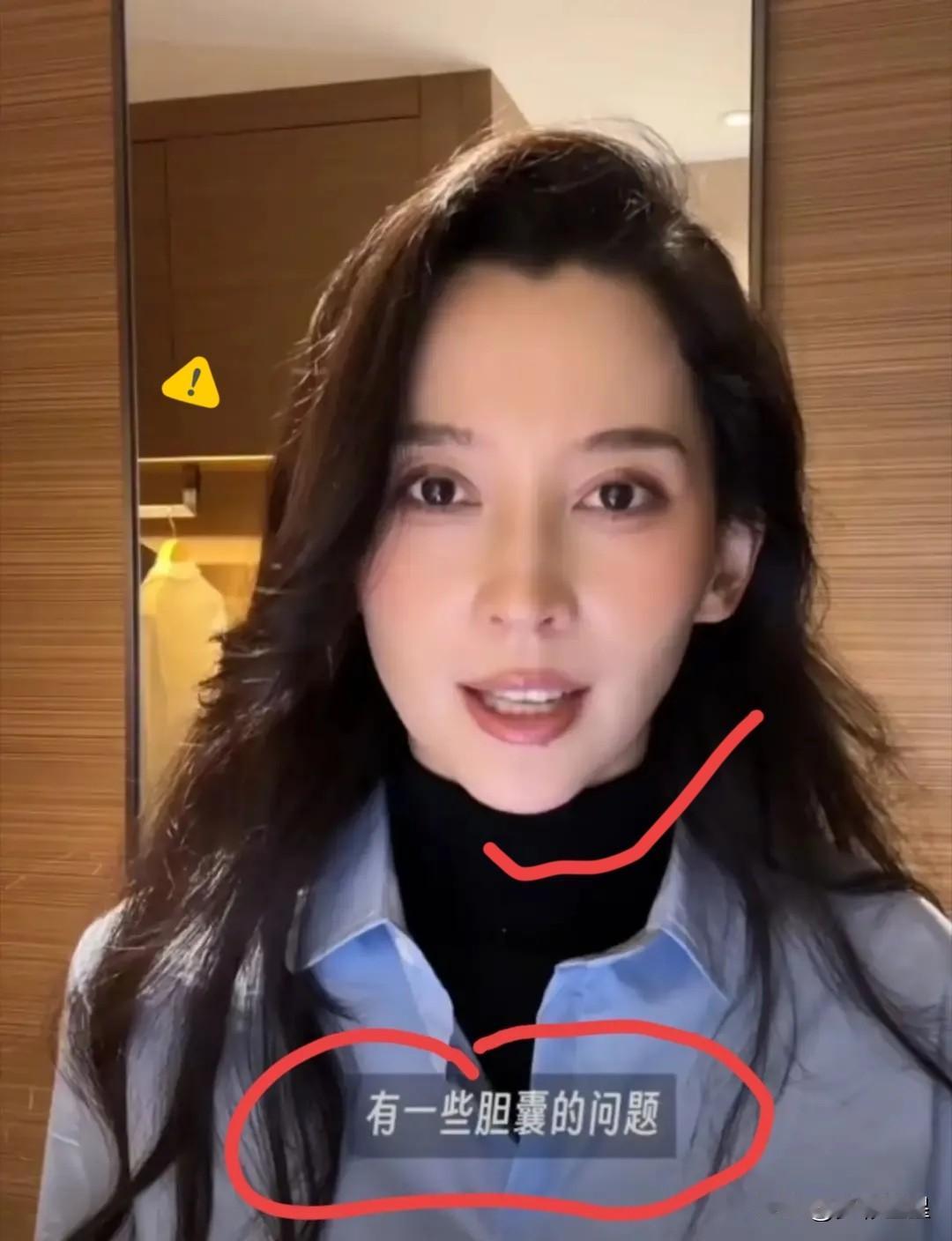 一夜醒来，汪峰懵了！
他想不通，
森林北还在这么年轻，居然就检查出身体方面的一些