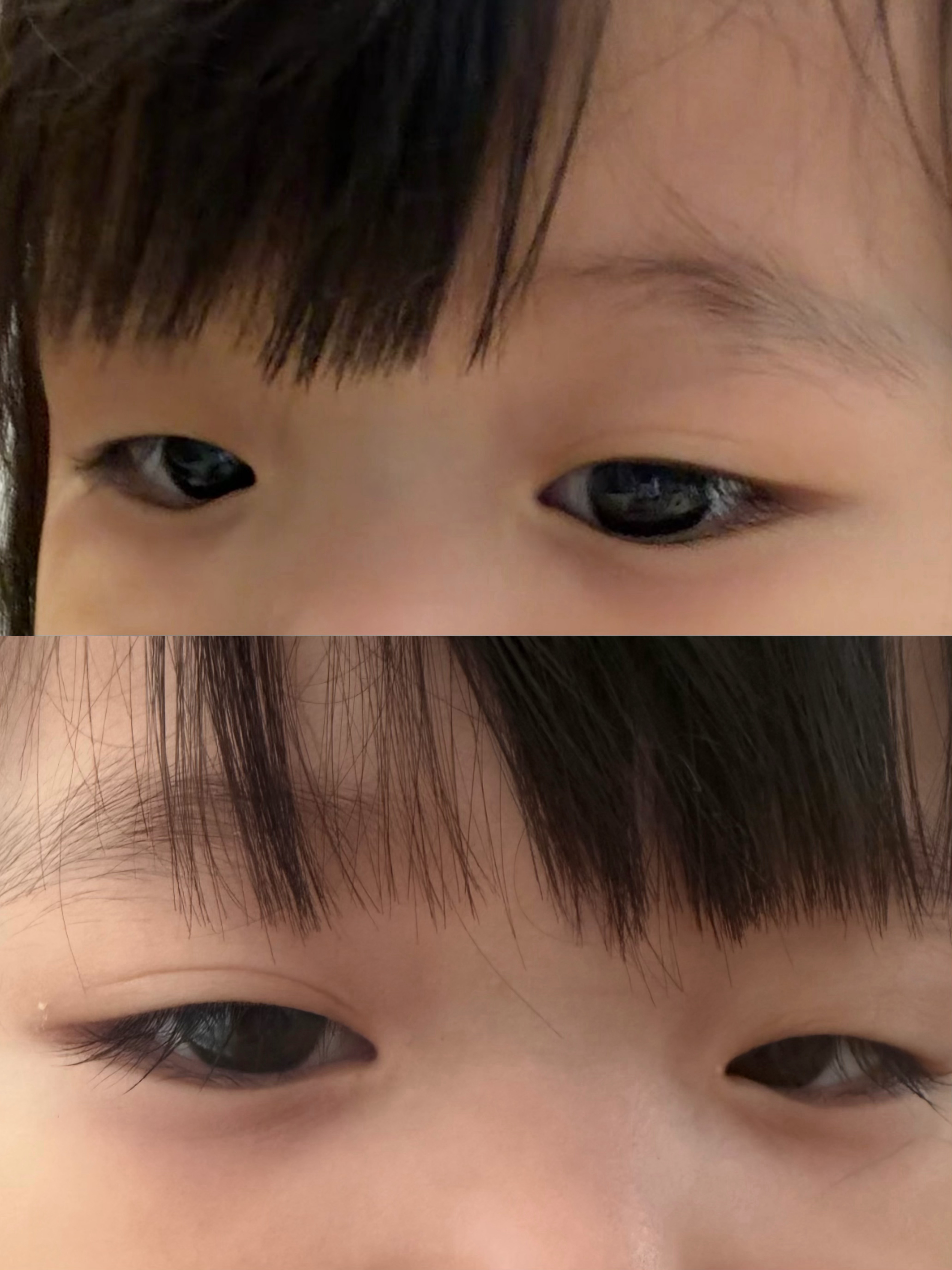 枣子有只眼睛变双眼皮了 昨天看还不太明显 今天看基本稳定了 第一时间来和小姨们分