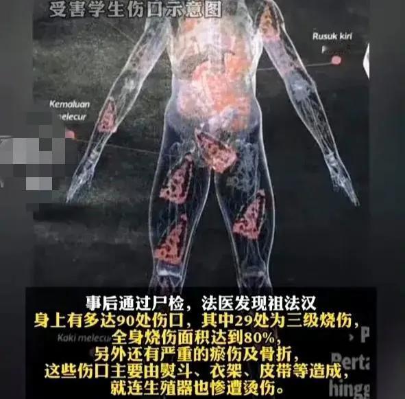 正义六命抵一命，正义得伸张！

马拉西亚六名霸凌同学致死的大学生由法院判处绞刑，