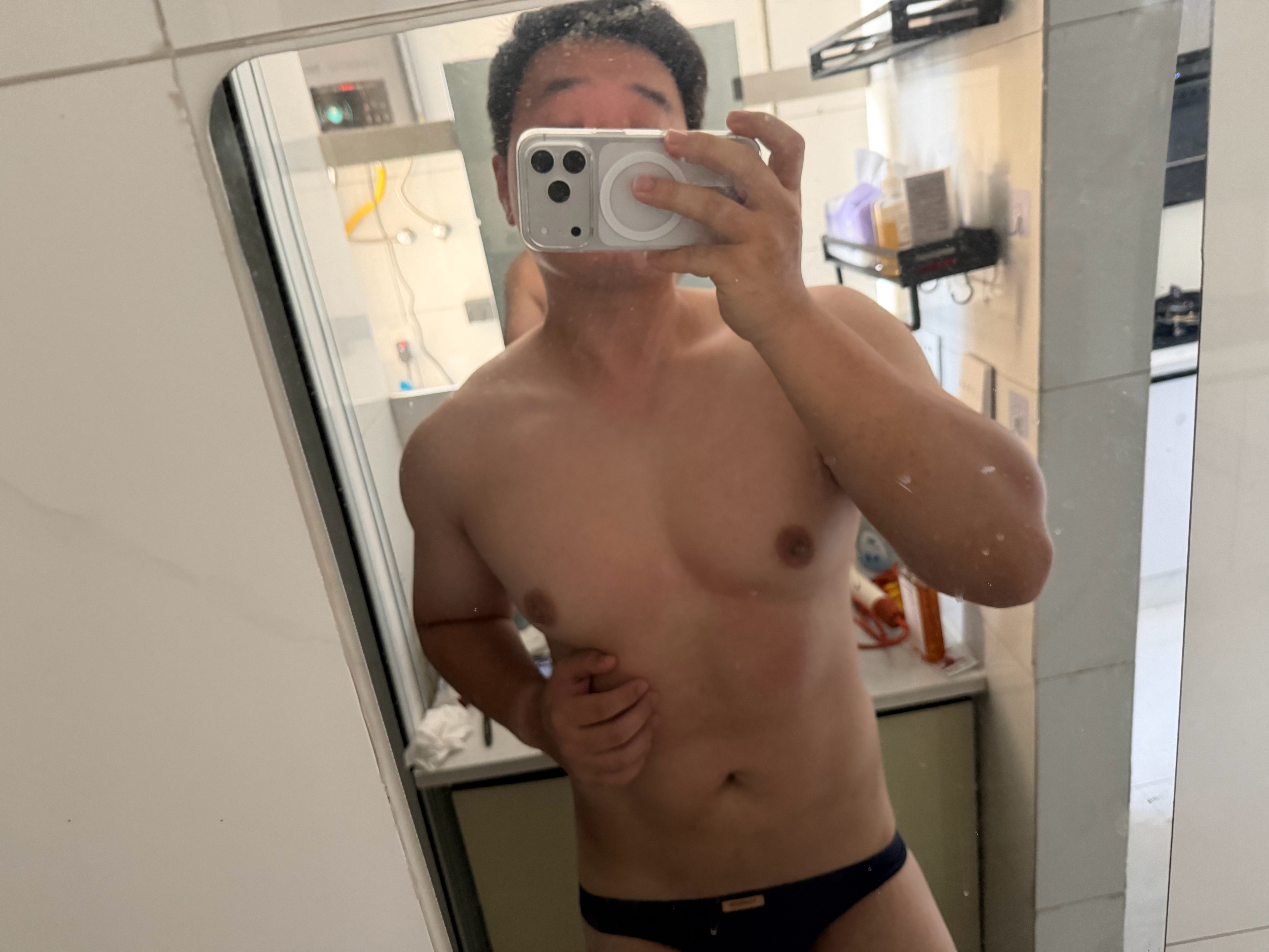 摸您。赶上公司团建啦，但身上的红疹怎么一直退不掉