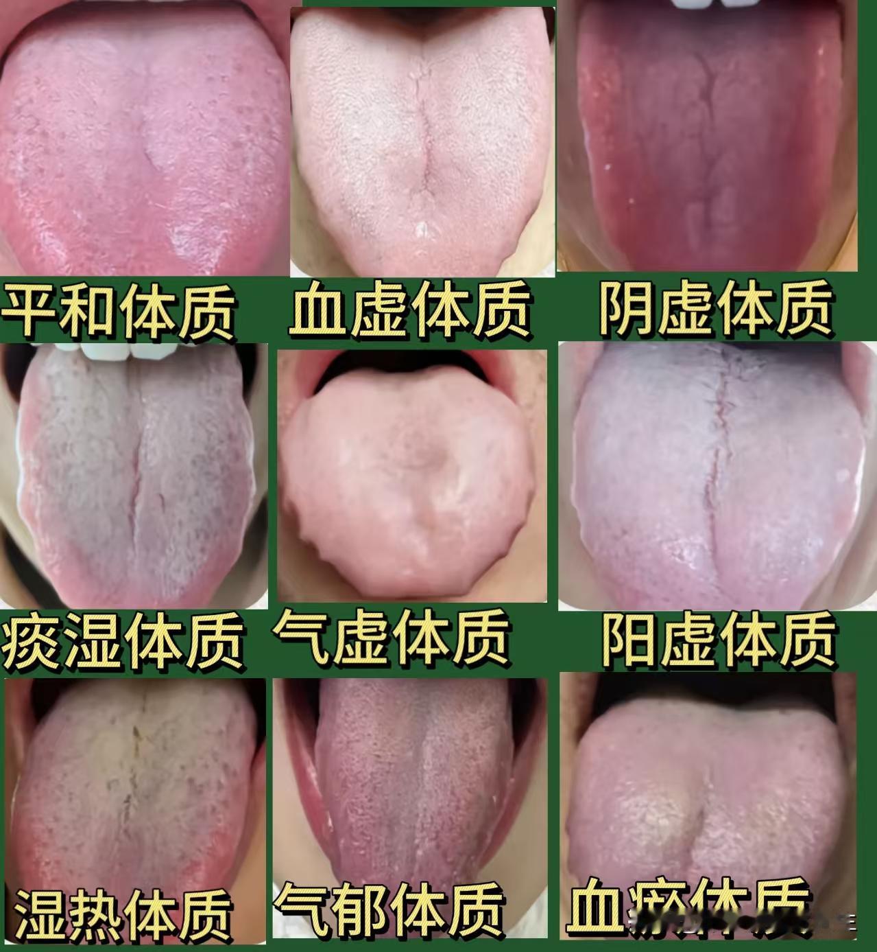 大家早上好！马上就要过年了，今天不太忙，抽空给大家分析舌象！你发我看，全天在线出
