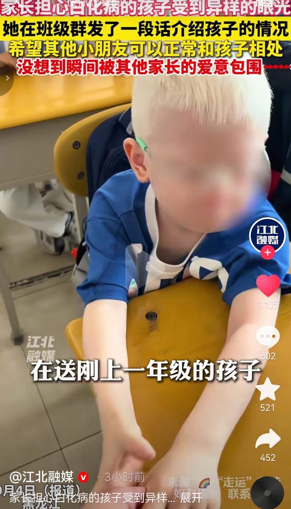 黑龙江白化病男孩上一年级，妈妈在班级群一番坦诚发言，收获满屏善意

黑龙江，有个