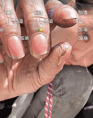 心疼每一位苦尽甘来的人，劳动人民的双手是最美丽的![强]