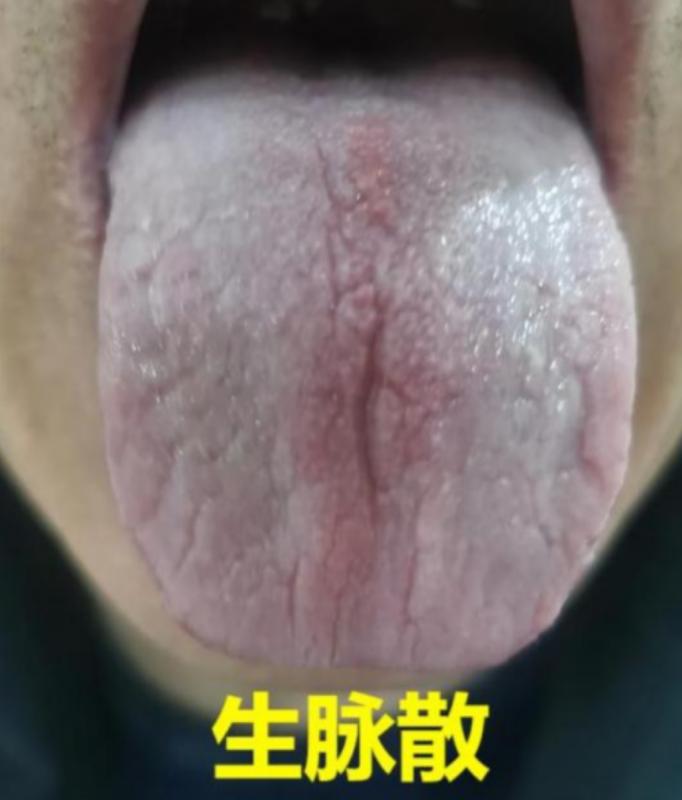 免疫力才是人体良药，分享四个药，有效提高免疫力，容易生病的人一定要知道！
 
1