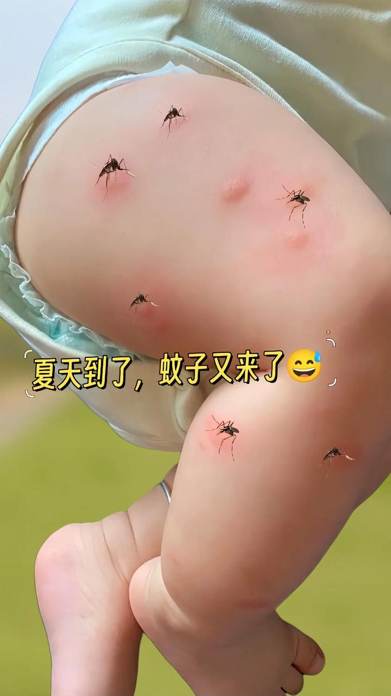 蚊子有多聪明，你知道吗？
       受害最深的是孩子， 这小东西，可精着呢！
