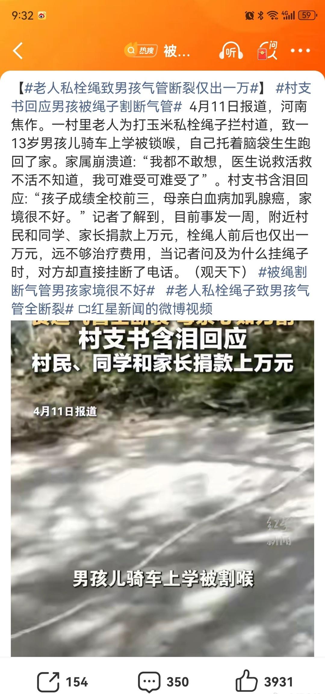 真的是作孽哦

老人为了打玉米私自栓绳拦村道

导致骑车上学的男孩被绳子隔断气管