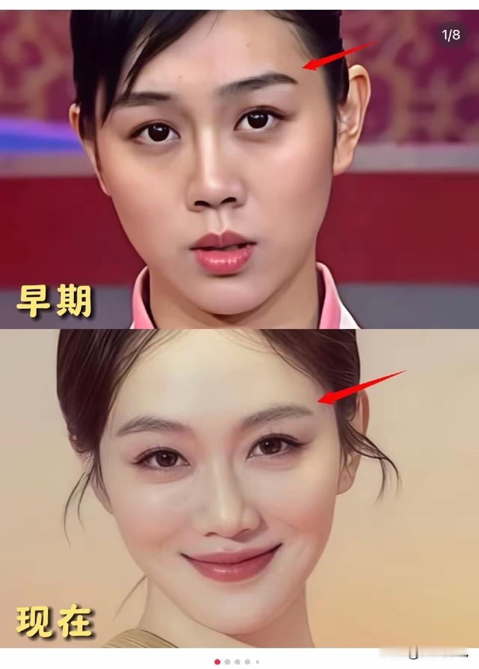 姜妍没有整之前
真的不好看
典型的东北大妞，所以，她一直不瘟不火！

她现在的美