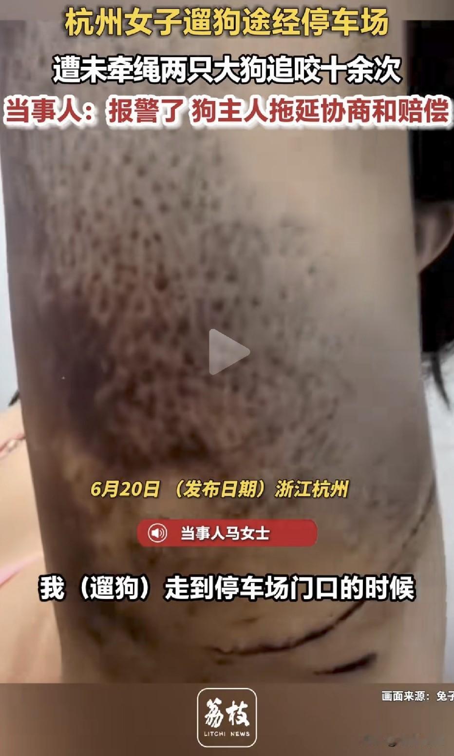 浙江杭州，一名女子在停车场内正常行走时，突然遭到两只未牵绳的大型犬疯狂追咬十余次