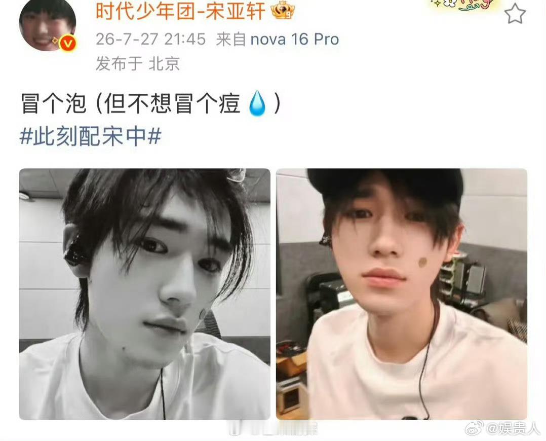 宋亚轩冒个泡不想冒痘宋亚轩脸上冒痘了好幽默，不想冒痘痘 