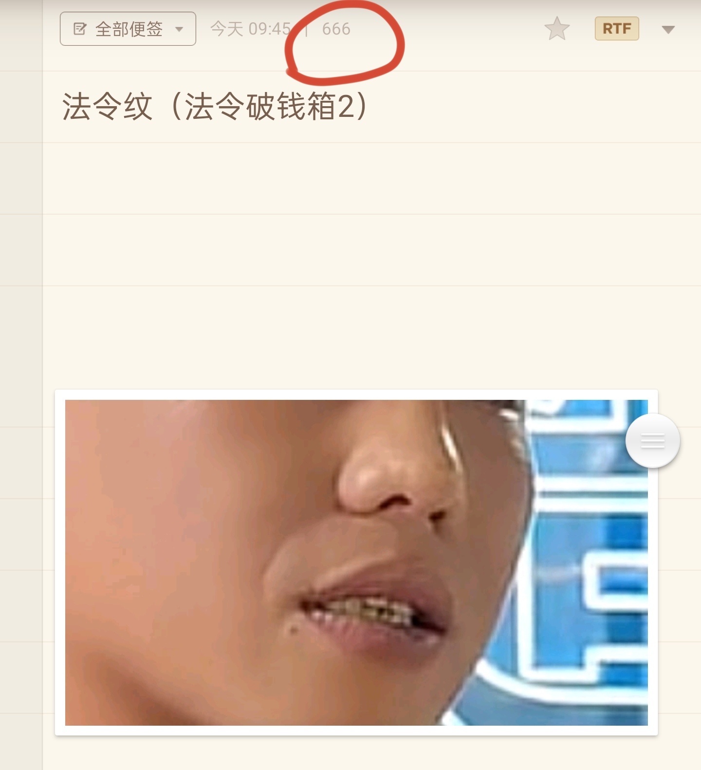 法令纹割鼻翼第二篇的分享，第一篇说了此类法令纹的性情，事业与财运，这篇重点分析的