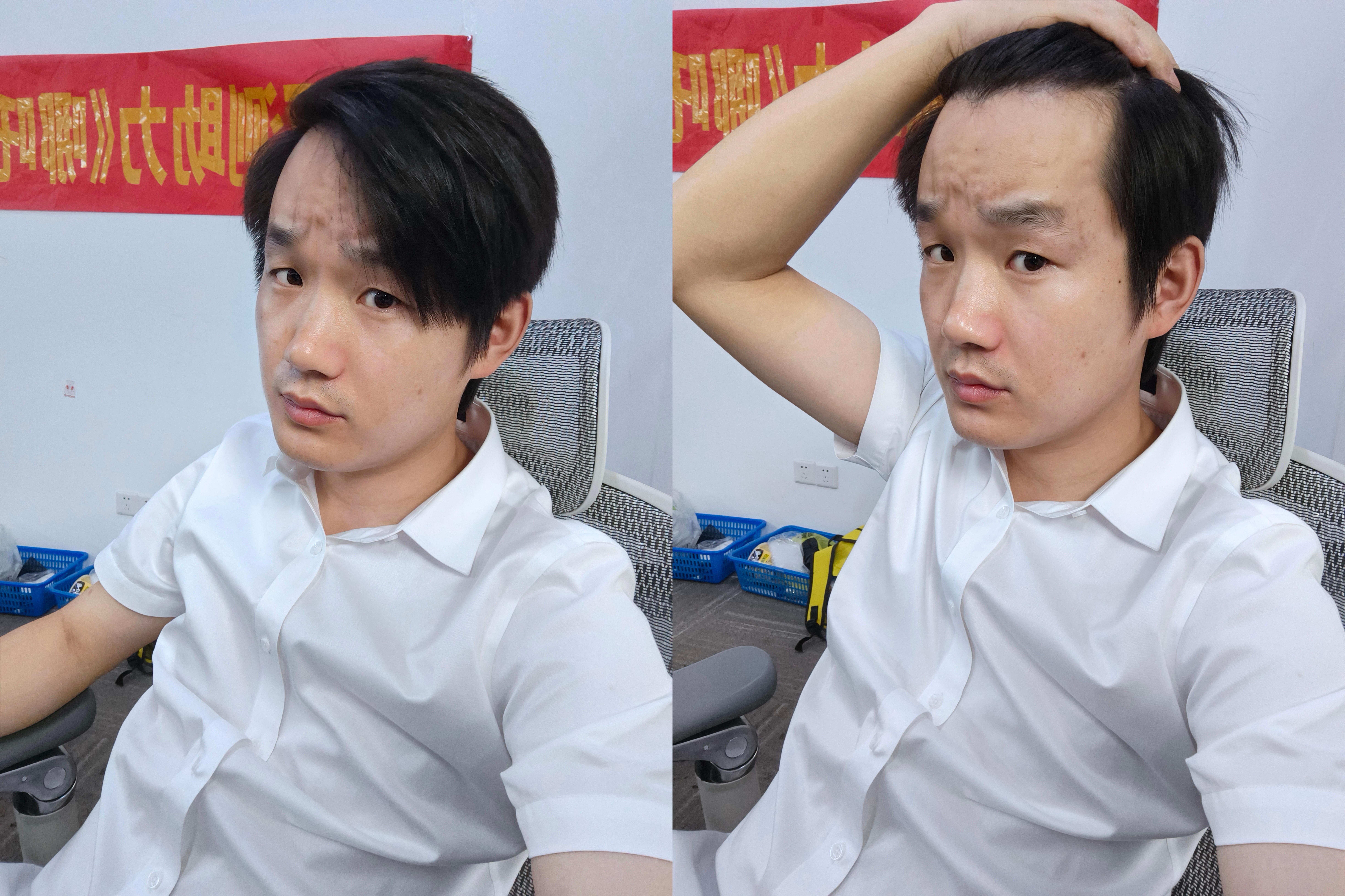 又认识了新词语：M形脱发。朋友说我头发虽长，但是也属于脱发，属于M形脱发，大家头