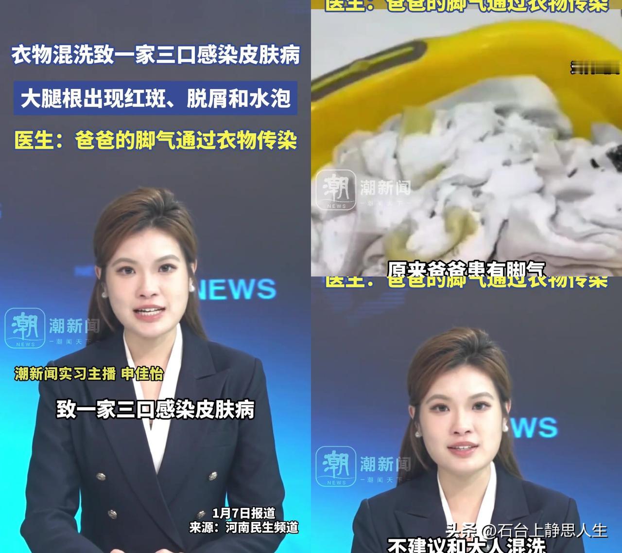 郑州一家三口因为洗衣机混洗，全得了皮肤病！

昨天河南民生频道报道，爸爸有脚