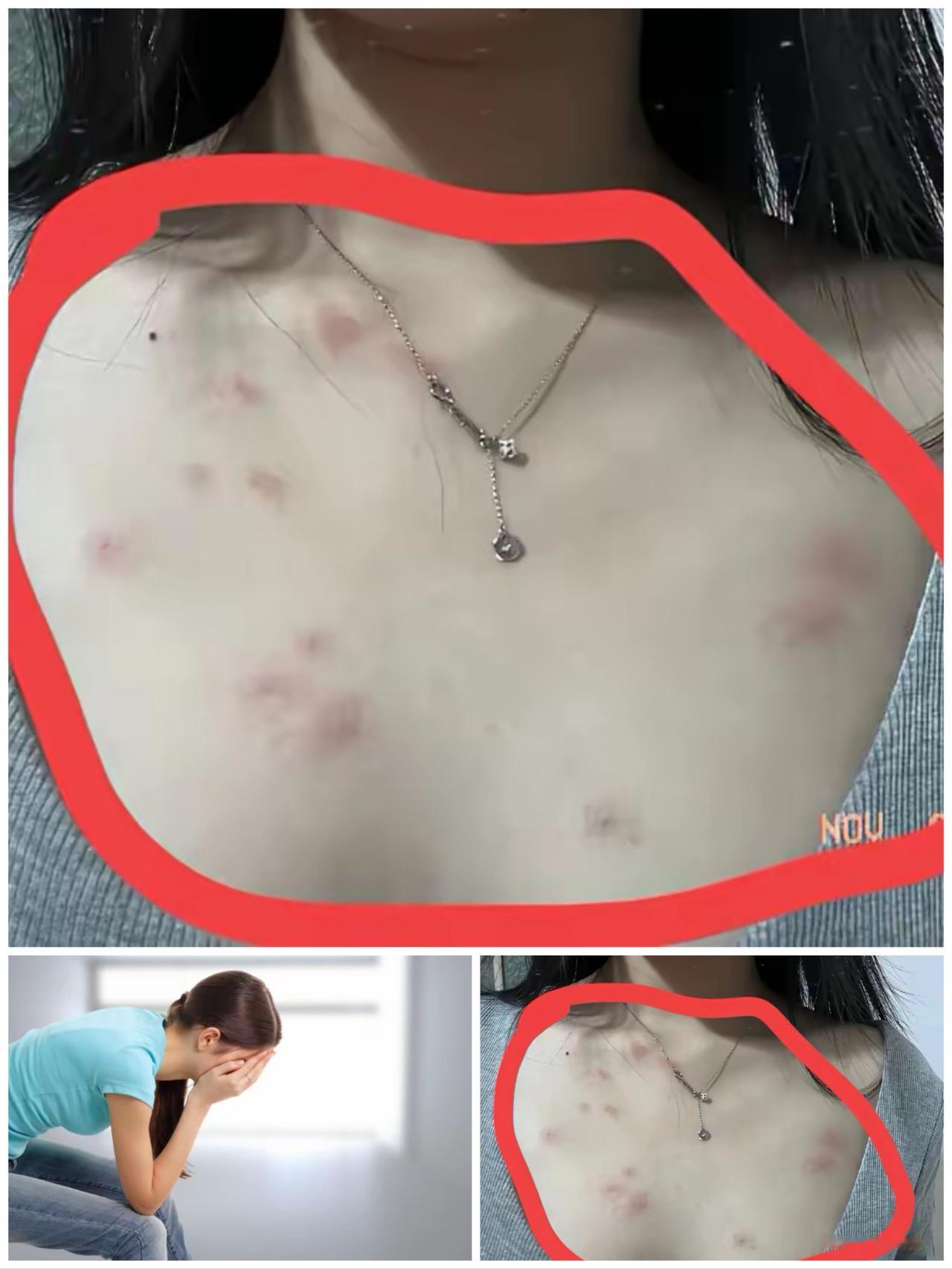 洁身自好仍中招？别让爱情，遮住你对健康风险的眼睛！这个是来自一个女粉丝的投稿，她