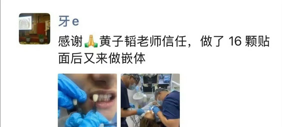 黄子韬怒斥偷拍牙医黄子韬做了16颗牙贴面被医生偷拍发朋友圈 偷拍确实不对吧