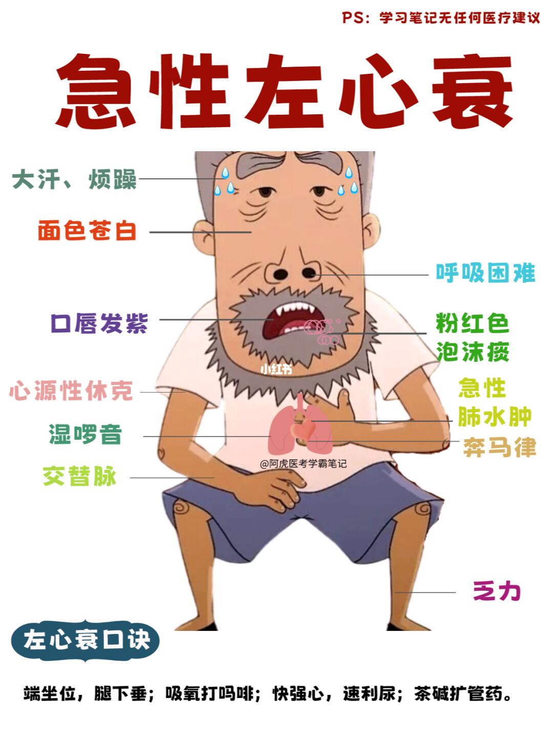 阿虎医考学霸笔记：当牛爷爷得了急性左心衰