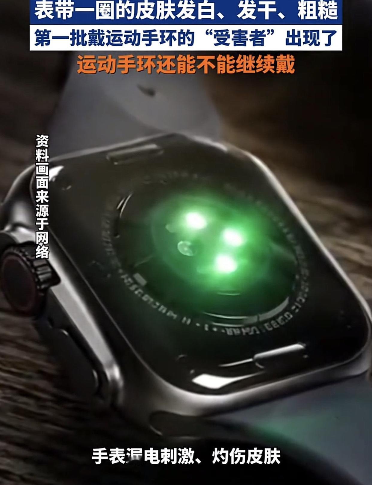 不少网友吐槽：“运动手环，智能手表，带久了皮肤变白，变硬，变糙，甚至溃烂，怀疑是