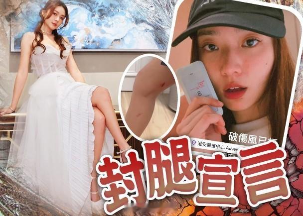 【On.cc】戴祖儀跌落坑渠變豬蹄　打破傷風針：心理創傷比較大戴祖儀昨日（23日