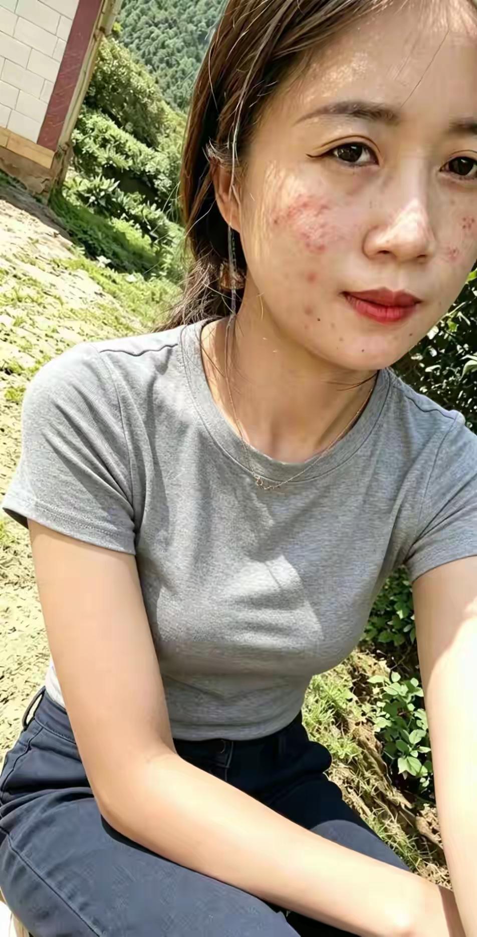 满脸的青春豆，还是内分泌失调，听说找个男朋友就好了
