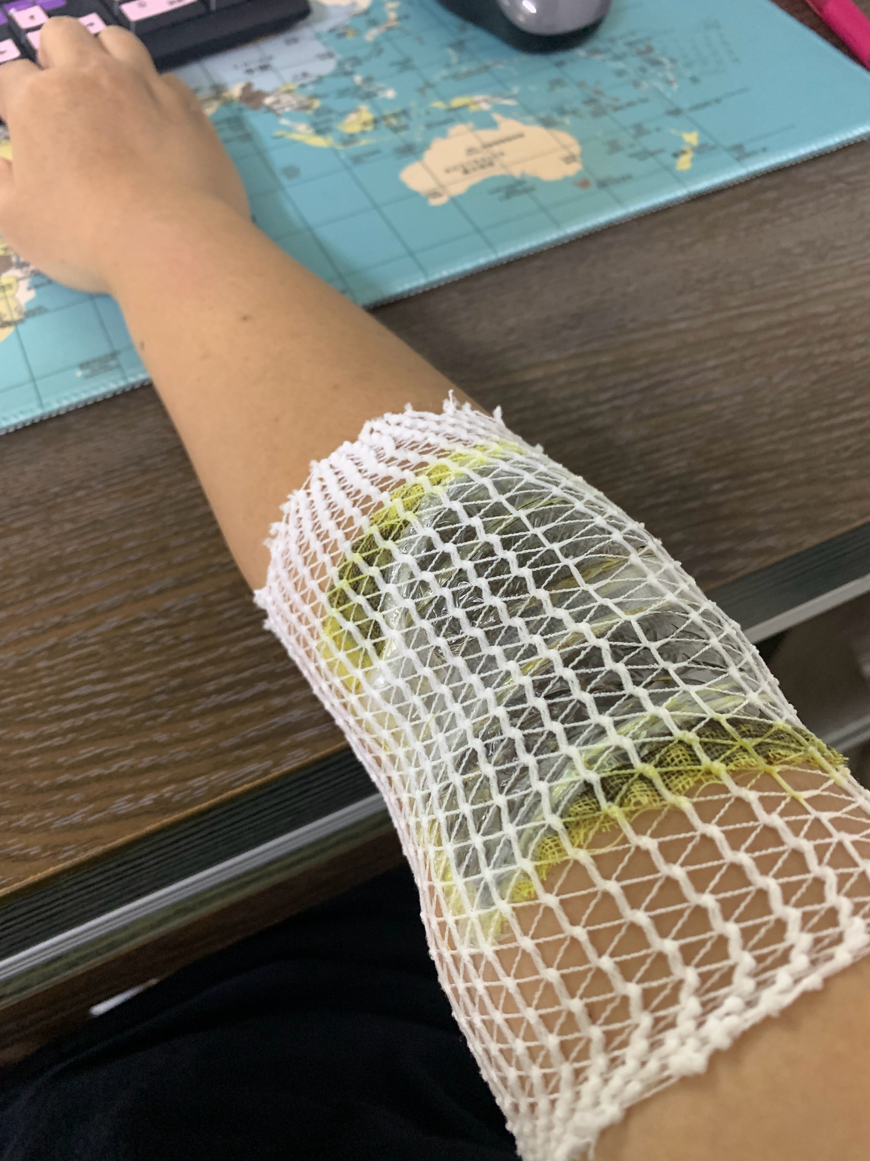 日子就是问题叠着问题 