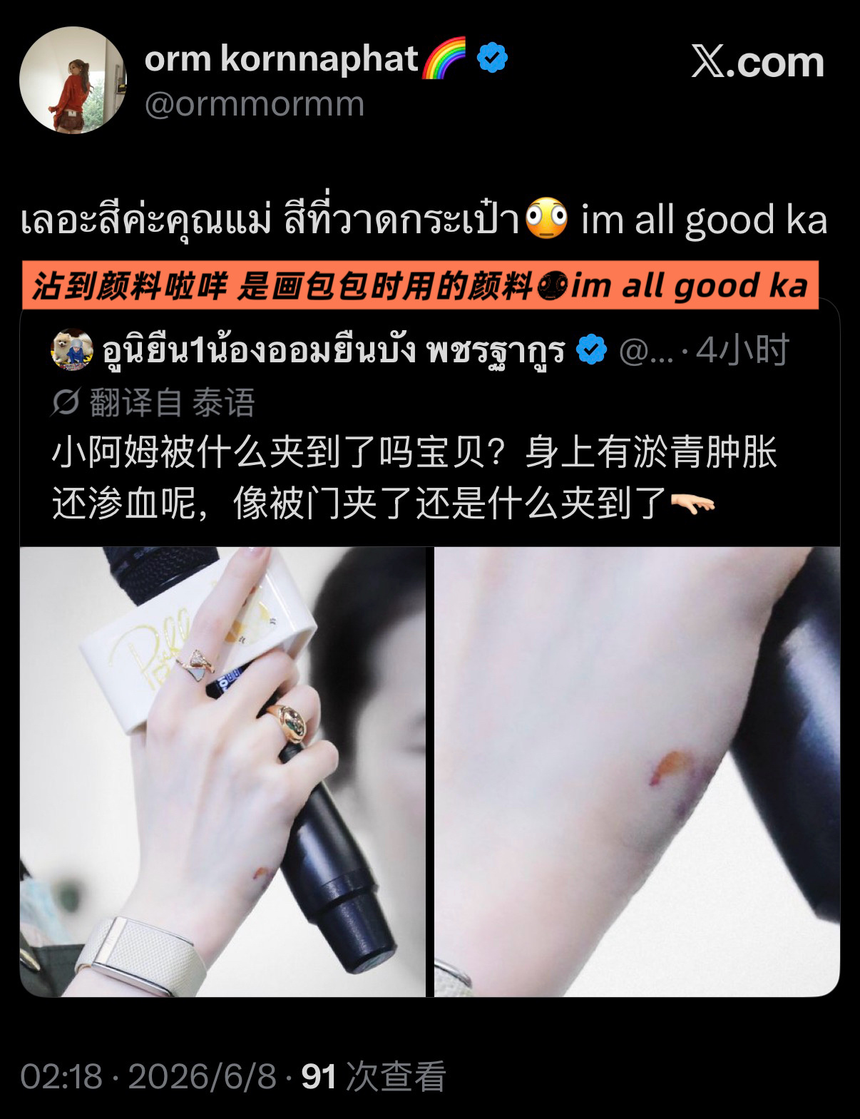 lingorm  😗lingorm 260608 奥比转推 