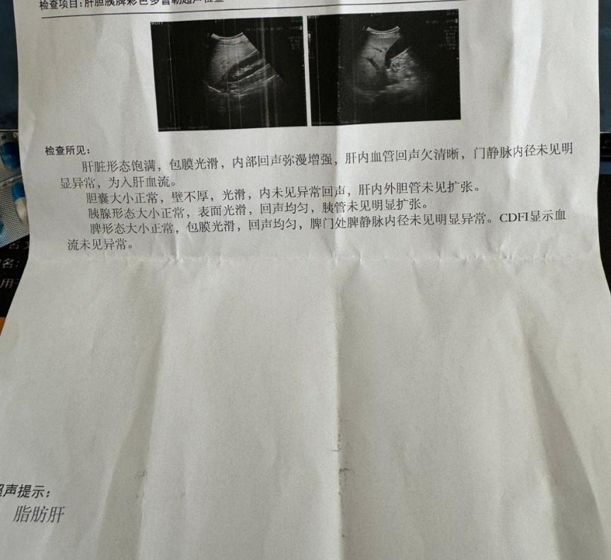 为何脂肪肝会缠上年轻人？如今脂肪肝的发病率在不断升高，并且发病年龄日趋年轻化。许