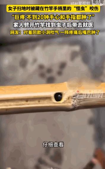 万万没想到！四川雅安，一位女子在家里扫地时，竟被扫把柄里窜出的一只“怪虫”狠狠咬