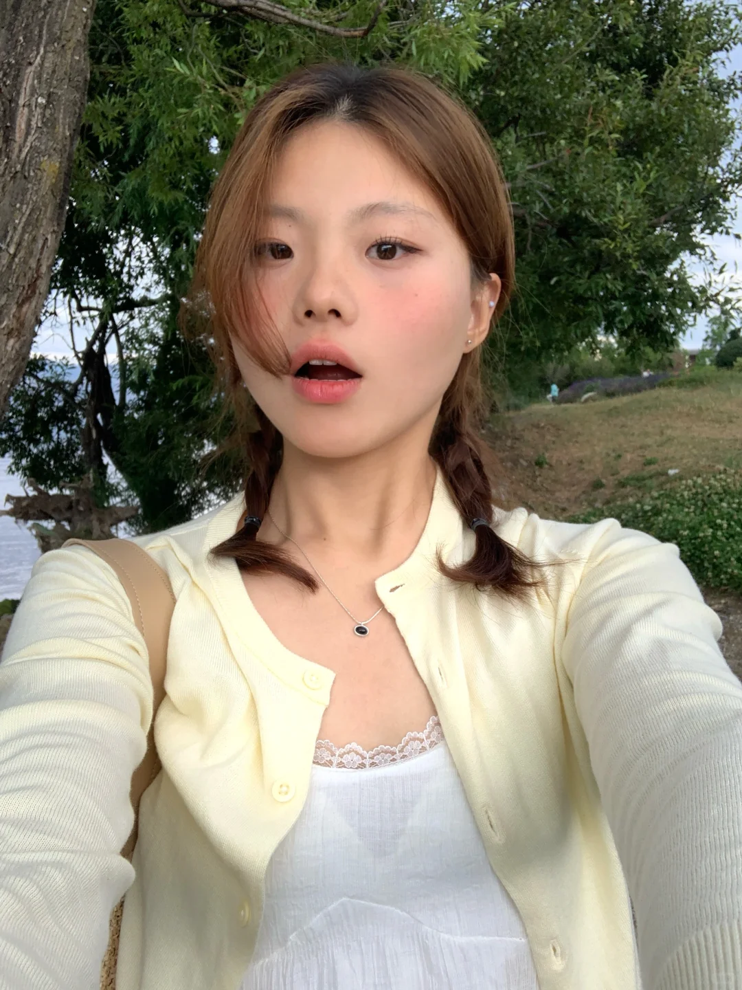 小圆脸也要变美🥹2年的牙套终于摘掉了