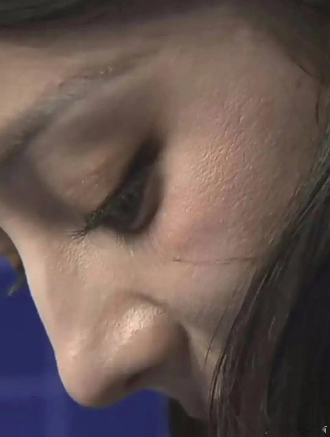 迪丽热巴皮肤这么不好吗 ​​​