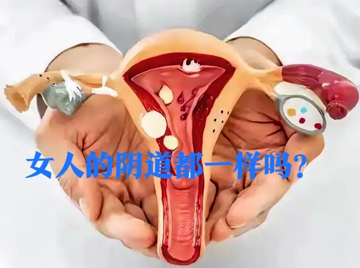 女人的阴道是不是都一模一样的？女性生殖道 妇科阴道彩超 

说实话，我以前也以为