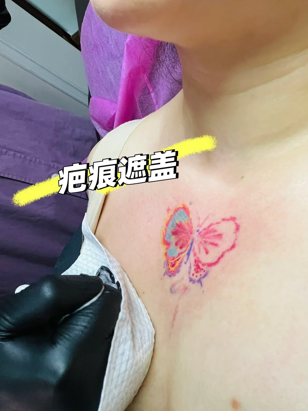纹身遮盖｜胸口🦋蝴蝶