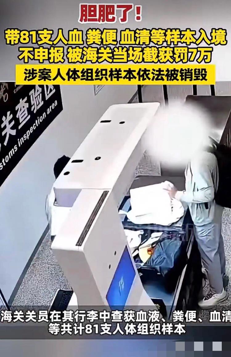 天津机场爆出少见的入境事件，一名男子悄悄携带81支人血、粪便还有血清入境，还没有