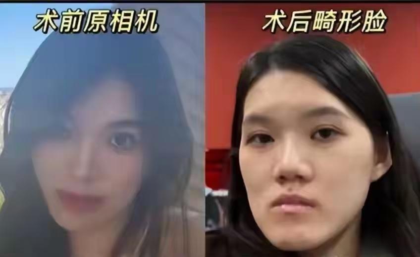 好好的一张脸，

给人家整成了“鞋拔子”，

又不是朱元璋，要不要这么够劲？

