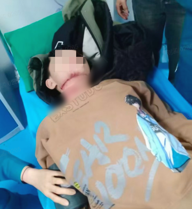 家属讲述沁阳男孩骑车遭绳索割喉细节：仍有一段气管未找到