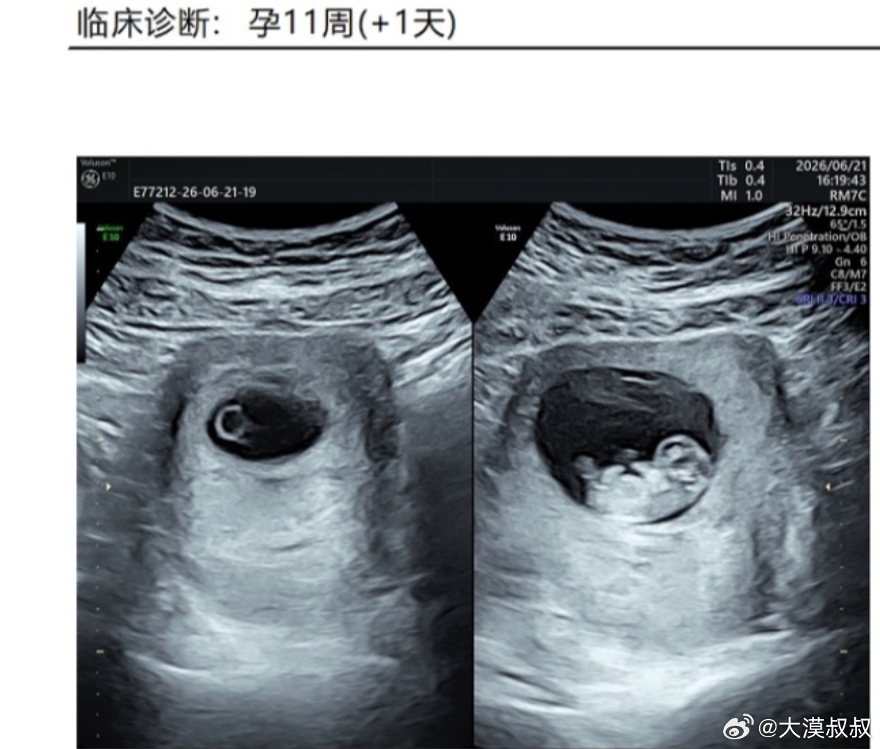 祝我父亲节快乐 开始胎教学武器常识！ 
