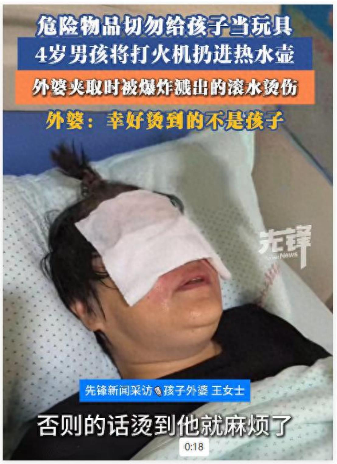 4岁外孙把打火机扔进热水壶，外婆用筷子一夹，整壶开水瞬间炸开！
 
8月14日，