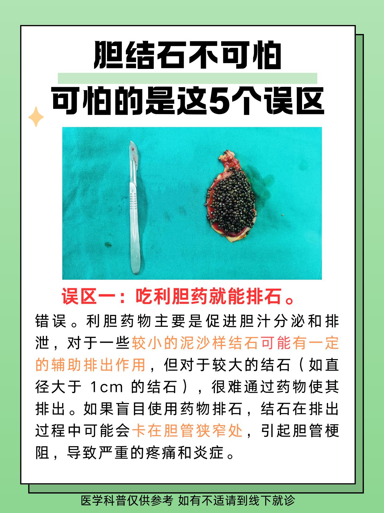 胆结石胆囊炎 胆管结石 胆总管结石 肝胆外科梁荔 利胆药