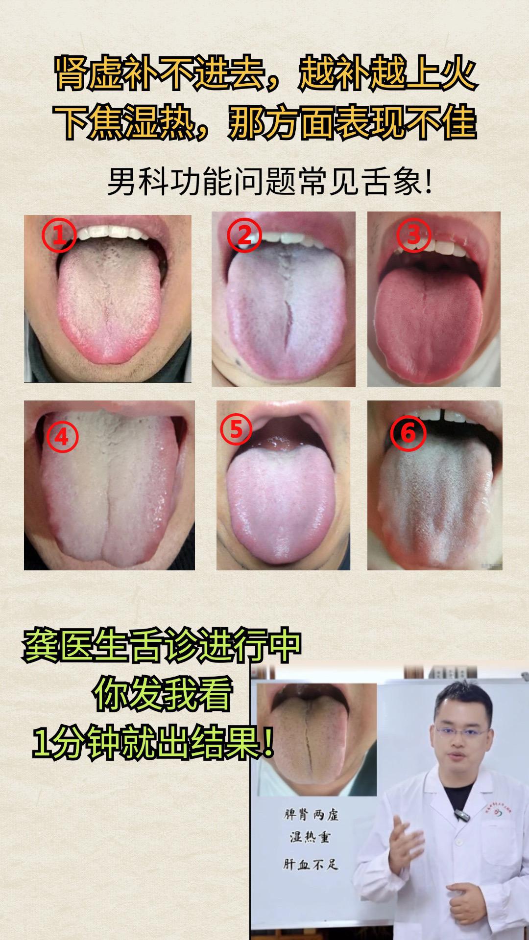 注意拍摄时光线清晰，拍到整个舌面#中医 #舌诊 #舌象科普
